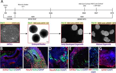 Veteran-derived cerebral organoids display multifaceted pathological defects in studies on Gulf War Illness